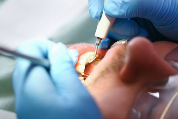 Best Emergency Dentist for Knocked-Out Tooth in Manchester, GA