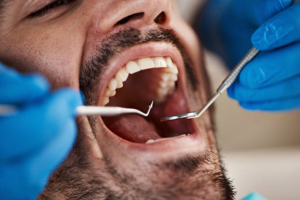 Best Emergency Dental Services for Seniors in Manchester, GA