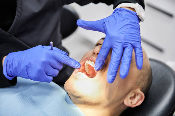 Best Emergency Dental Care for Abscessed Tooth in Manchester, GA